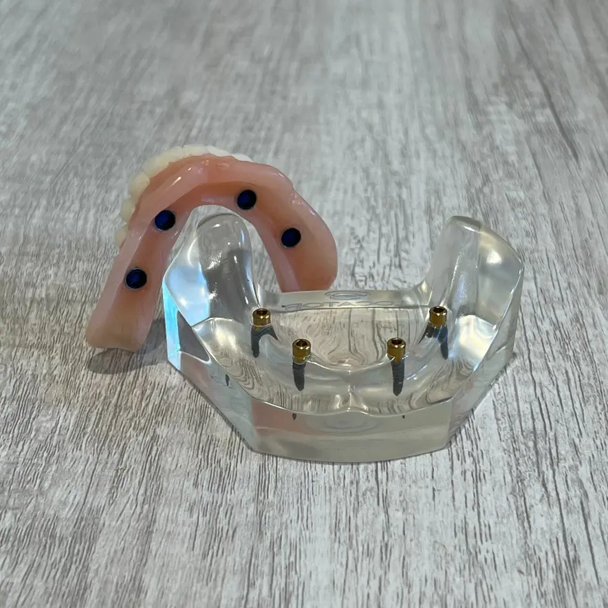snap-in implant dentures Mt Juliet, TN