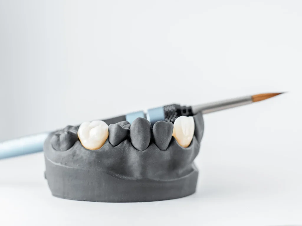 jaw model to display dental crowns Mt Juliet, TN