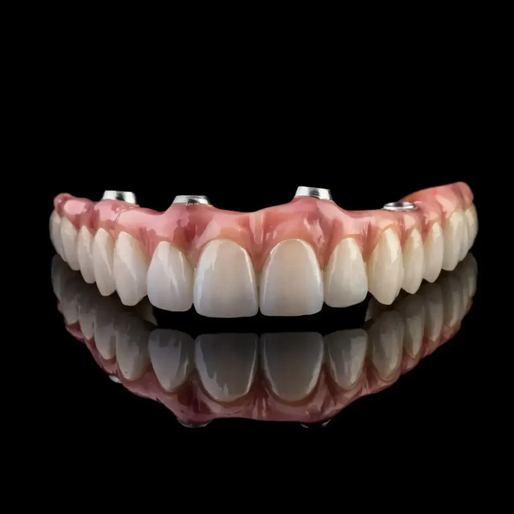 all on 4 dental implants | teeth in a day